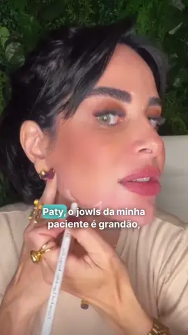 Vamos falar de toxina no jowls? Dica super prática para te ajudar com pacientes que querem tratar essa região!!  Gostou do conteúdo? Deixe seu ❤️ nos comentários. #drapatriciaregina #hof #harmonizacaoorofacial #jowls #toxina #toxinabotulinica
