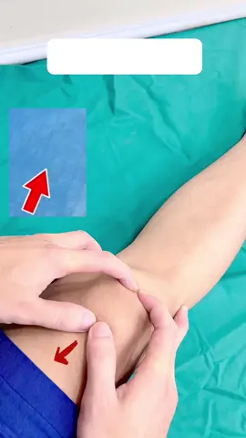 Di động bánh chè 🦵 Vận động xương bánh chè ,bạn có thêm khả năng vận động khớp gối . Xương bánh chè đóng vai trò quan trọng trong chuyển động và sự ổn định của khớp gối . Xương bánh chè cho phép đầu gối của bạn di chuyển nhẹ nhàng và chuyển động có kiểm soát khi gập gối hoặc duỗi thẳng  Liên hệ để được tư vấn và đặt lịch khám miễn phí 👨‍⚕️#daychangcheo #phcn #dcct #longbien #suckhoechomoinguoi #xuhuong  #khopgoi #vietnhat 