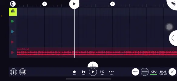 Em có nhớ anh không ? #mseuu #remix 