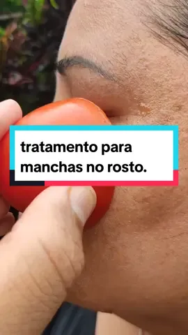 tratamento para manchas no rosto #remedioscaseirosnaturais #beneficios #saùde #dicas #receitasnaturais 