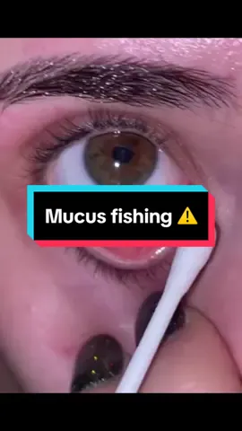 #eyelashes #eyelash #tiktokitalia #makeup #skincare #mucus #mucusremoval #mucous #mucousremoval #eye #eyes #eyecleaning #eyescleaning #eyemucous #eyemucus #mucusfishing #eyesmucus #cottonfioc #accadeoggi 