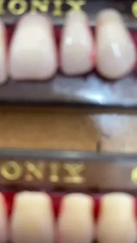Dentes de estoque 💚 Vem conferir nossa cartela de possibilidades!  #dentes #bionix #odontologia #odonto #dentalhygienist 
