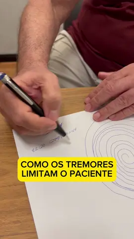 Tremores acusados pela Doença de Parkinson e pelo tremor essencial, as discinesias, dificultam demais a vida do paciente e tiram quase que completamente a qualidade de vida.  Mais que isso, colocam a autoestima lá em baixo, impossibilitando situações como a desse vídeo, onde o paciente sequer consegue assinar o próprio nome.  Felizmente, a tecnologia médica avançou e cirurgias como o DBS, o marca-passo cerebral, conseguem atingir o alvo dos tremores, melhorando fortemente a qualidade de vida do paciente.  Neste caso que mostro, essa é uma das avaliações que fazemos, além de todos os exames, antes de chegar à conclusão se o paciente se encaixa na cirurgia.  #discinesia #tremor #tremoressencial #doencadeparkinson #maldeparkinson #parkinson #neuro #neurocirugia #neurocirurgiao #medico 