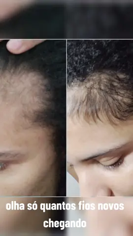 #eudora #aceleracrescimento #aceleracrescimentoeudora 