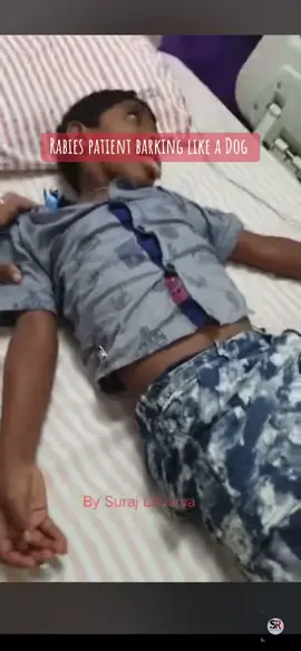 #rabies #illness #child #help #foryoupage #fypage #fypシ゚viral 