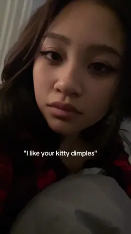 I love them~ <3🐈‍⬛ #dimples #fyp #fy #fyyy #foryourpage 