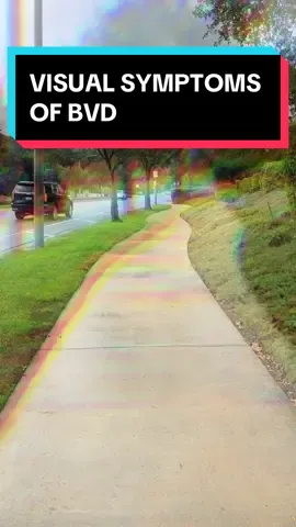 Visual symptoms you may experience with BVD (Binocular Vision Dysfunction)… #visualsymptoms #viral #bvd #binocularvisionmatters #blurryvision #tunnelvision #adhd #migraines #peripheralvision #vision #eyeexam #optometrist 