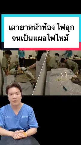 เผายาหน้าท้อง จนไฟลุกไหม้ กลายเป็นแผลใหญ่ #คิดไม่ออกบอกหมอต่อ #หมอต่อ #หมอต่อskindream #dermatologist #หมอผิวหนังเชียงใหม่ #skindreamclinic #เผายาหน้าท้อง #ไฟไหม้ท้อง #แผลไฟไหม้ 