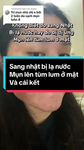 Trả lời @maanx hối hận khi k biết đến sản phẩm này sớm hơn , để k bị tốn khá nhiều tiền trị mụn #srumtrimunmoctuyet#nhậtbản🇯🇵 #xuhuongtiktok2023 #xuhuong 