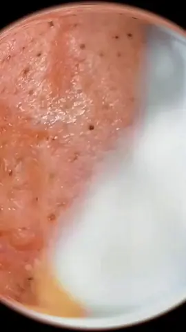 Relax with me #skincaretips  #acneskincare  #LearnOnTikTok  #doctor  #viral  #foryou
