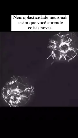 Processo de neuroplasticidade neuronal quando você aprende algo novo: células cerebrais construindo novas sinapses. Podemos observar o prolongamento axonal do neurônio transmissor indo em direção ao neurônio receptor, para a formação de uma nova sinapse.  #foryou #fy #fypシ #sinapse 