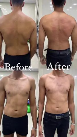 #تقويم_العمود_الفقري # #آلام_ الظهر #علاج_طبيعي 