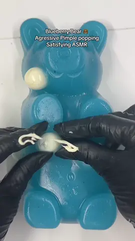 Blueberry creamy pimples popping #satisfying #foryou #fypシ゚viral🖤tiktok #CapCut #asmr #viral #relatable #longervideos #mochipimplepopping #pimplepop #gummybear 