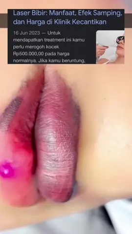 Garansi 100% uang kembali, apabila barang yang datang tidak sesuai🥰🥰 #glossmen #Perawatnbibir #Pencerahbibir #lipsticktutorial