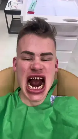 O Golpe da Lente que Influencer faz 🥴#desgastedental #coroadentaria 