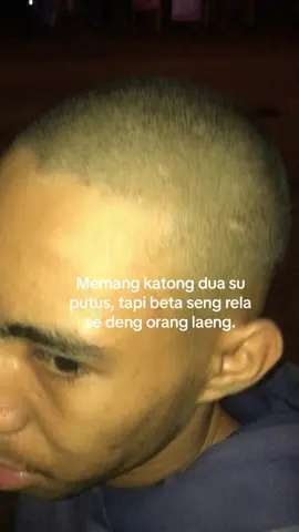 Botak