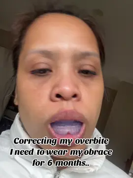 #myobrace #australia 