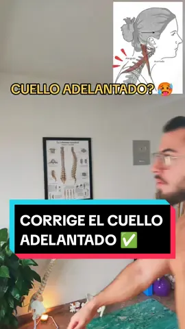 Enséñale este ejercicio a quien sufra cuello adelantado o cabeza adelantada En incontables ocasiones, el cuello adelantado aparece como resultado de un desequilibrio muscular por parte de esternocleidomastoideos y flexores profundos del cuello Cuando tus esternocleidomastoideos permanecen demasiado tensos, estos, junto con tus escalenos comienzan a adelantar tu cabeza de su correcto eje central, provocando no solo una alteración en tu estética, sino que también un fuerte dolor de cuello, cervicalgia, rectificación cervical, vértigo o hernia discal cervical Con este fabuloso ejercicio conseguirás liberar tanto tus esternocleidomastoideos como escalenos, y al mismo tiempo estimular tus flexores profundos del cuello Algo que indudablemente te interesa si lo que pretendes es abordar y prevenir el cuello adelantado y mejorar tu postura #pablopilatesreal #cuelloadelantado #cuellodetexto #jorobadebufalo #joroba #cifosis #chepa #dolordecuello #malapostura #controlpostural #dolorcervical #textneck #neckhump #postura #posturacorreta 