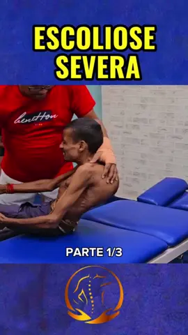 Parte 1 Escoliose severa ele sofre a 20 anos com as dores! #scoliosis #chiropractic #escoliose #chiropraxia #adjustment 