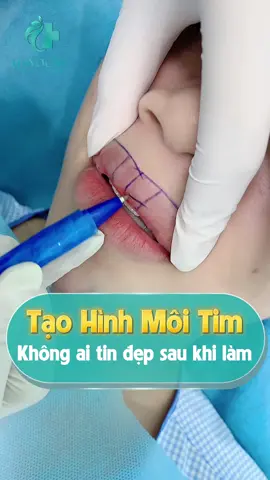 Không ai tin Đẹp sau khi làm xong...#moitimdep #catmoi #thammy #goclamdep #pttm #lamdep #thammyhayoung #foryou