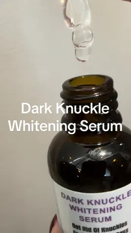 Get rid of dark knuckle in 7 days @DRTY #knuckleserum #darkknuckle #darkknucklesremover #serum #tiktokmademebuyit #skintoksg #careforskin #createtowin #fyp #fypsg 