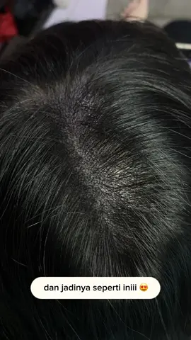 #sulamrambuttangerang #solusikebotakanrambut #micropigmentation 