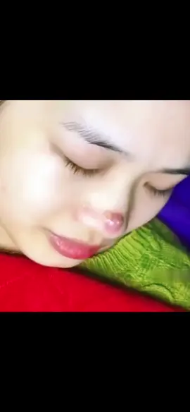 #cravos #brufoli #blackhead #zit #pimples_brufoli_ #popper #pimple #acne #pimples_brufoli #popping #zits #asmr #pimples #pimplepop #granosyespinillas #granos 