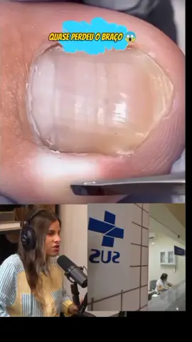 atendimento do SUS #sus #shantal #queimadura 