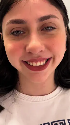 Snap on smile 🤩 ‎الفينير المتحرك وجمالة🥰 ‎١- بيداري الفراغات والمسافات بين الأسنان. ‎٢-بيداري الكسور والأسنان المفقودة. ‎٣- تقدر تختار اللون اللي يناسبك . ‎للحجز:01066959505