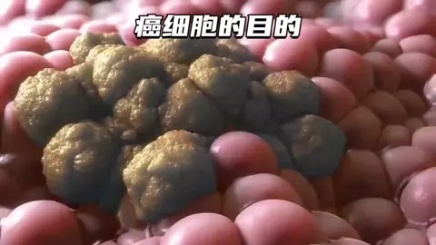 为什么癌细胞要杀死宿主，选择和人类同归于尽? Why do cancer cells kill their hosts and choose to die with humans? #生活分享 #知识分享 #诚实做人 #诚信做事 #lifesharing #lknowledgesharing #honestlife #karnivalsinarbestari #tiktokshopnextrising #LearnOnTikTok 