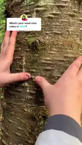 Ooo hmyeah tree pimples #pimple #fyp #pop #satisfying  