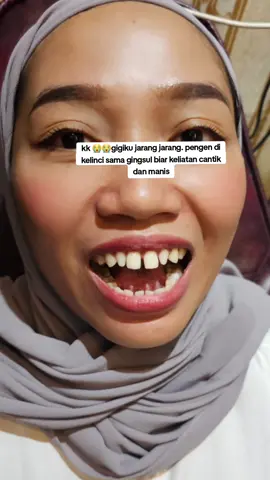 Membalas @alisaaa2284 😇😇#fouryoupage #xyzbca #fyp #CapCut #viral 