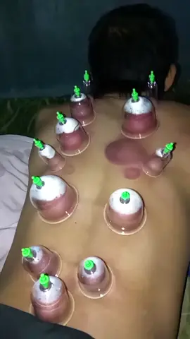 #highlight #tiktokviral 