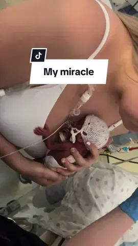 9 months old and look how far we’ve come already. Tiny but mighty !! 🥺🤍 #tinybutmighty #nicujourney #prematurebaby #micropreemie #prematurityawareness #miracle #unstoppable 