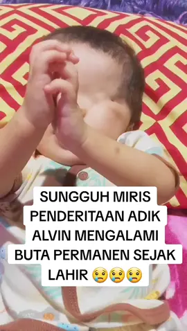 ADIK ALVIN BUTA PERMANEN SEJAK LAHIR 😢😢 #solidaritas_tanpa_batas  #solidaritasinsanpedulisesama  #pedulisesama  #fyp #viral 