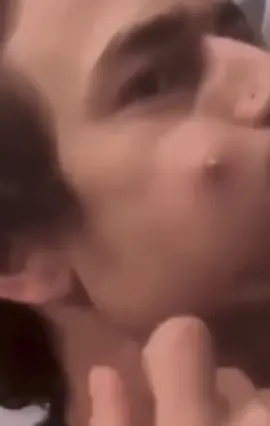 #cravos #brufoli #blackhead #zit #pimples_brufoli_ #popping #asmr #zits #pimples #granos #acne #popper #pimple #pimples_brufoli #granosyespinillas #pimplepop 