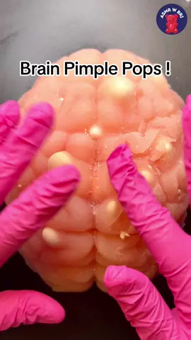 Brain Pimple Pops! 🧠 #satisfying #asmrtoys #fyp #relax #acne #brain 