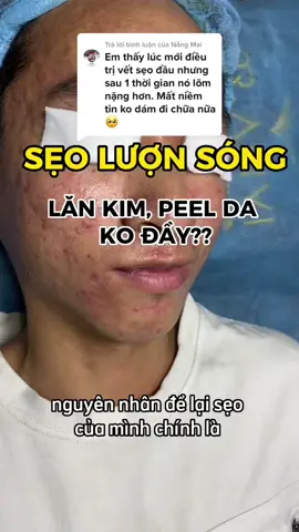 Trên tiktok giờ các bạn có thể thấy quá nhiều nơi trị sẹo, các bạn cứ nghĩ 