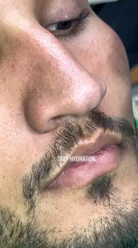 🤩Elimina YA tus puntos negros con la  iPro Pala Ultrasónica de Aureami✨