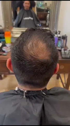 ✨Toppik hair توبيك هير المنتج الأفضل في العالم لفرغات الشعر .  ✅ توبك هير هو منتج امن وليس به أي مواد كيميائية او ضارة للشعر يصلح لفراغات الشعر والشعر الخفيف . ✅ توبيك هير عبارة بودر يتم رشه على الشعر الخفيف ليلتصق ب الشعر و يقوم بتغطية الفراغات. ✅ توبيك هير مقاوم للأمطار والتعرق وتتم إزالته بالشامبو فقط مناسب للبنات والرجاله❤️❤️ #dr #cosmotics 