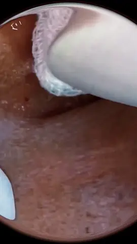 Relax with me #spa  #skin  #SkinCare101  #skincaretips  #skincareroutine  #acneskin  #acnetreatment  #acneproneskin  #acneskincare  #care  #face  #LearnOnTikTok  #doctor  #viral  #foryou
