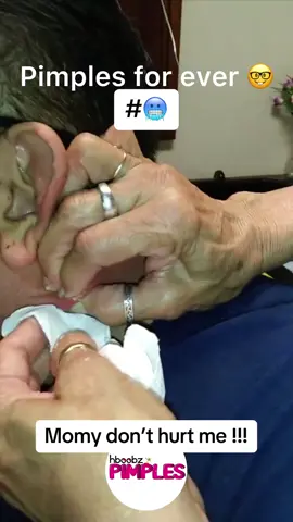 #pimple #medical #horror #blackhead #bigpimple #pimpleremoval #disgusting #pimplepop #cystexplosion #squeeze #squeezeyuk #skincare #acnetreatment #pimples #satisfying #acne #whiteheads #cyst #abscess #verysatisfying 