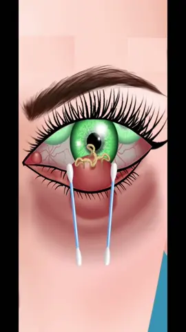 Eye Pimple Clean