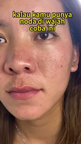 Krim pemutih yang direkomendasikan kepada saya oleh seorang teman yang berprofesi sebagai dokter hasil yang baik#flek#flekhitam#whiteningcream #kulitkusam