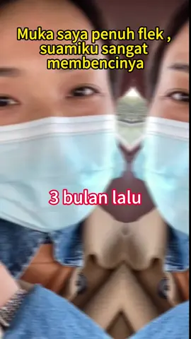 Krim pemutih yang direkomendasikan kepada saya oleh seorang teman yang berprofesi sebagai dokter hasil yang baik#flek#flekhitam#whiteningcream #kulitkusam