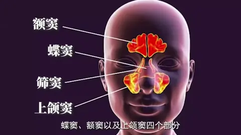如果你也经常被鼻塞困扰，那你一定要看完这个视频. If you are often troubled by nasal congestion, then you must watch this video. #生活分享 #知识分享 #诚实做人 #诚信做事 #lifesharing #lknowledgesharing #honestlife #karnivalsinarbestari #tiktokshopnextrising #LearnOnTikTok #2023Unwrapped 