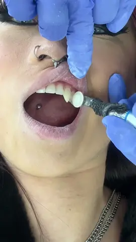 Dentist Reveals The Secrets To Viral Vampire Teeth! 🧛🦷 #vampire #teeth #dentist #trend