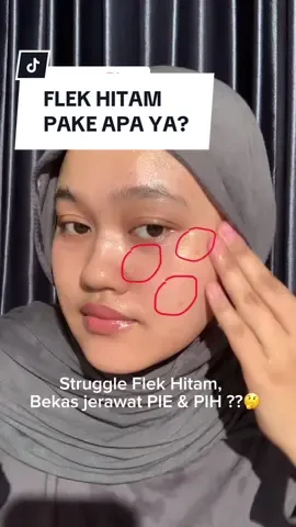 Membalas @Zir🅰️📍 FLEK HITAM PAKE APA YA? bisa cobain combo Glad2Glow yang putih ya🤍kandungan utamanya pake YUJA & SYMWHITE 377 fokusnya untuk dark spot, bekas jerawat PIE & PIH. serumnya aku suka karena ringan, mudah meresap, dan gak cekit-cekit, padahal aromanya cukup strong. bantu juga untuk menekan produksi melanin + melawan radikal bebas loh👍🏼 moist nya favoritku, texturenya nyaman. kulitku oily pake dikit udah cukup untuk semuka, lembapnya nampol👍🏼gaada rasa lengket. Progress yang aku rasain PIE ku berkurang deh di bagian pipi.. bisa lihat before after di video yaa!! 💰40 ribuan tapi sebagus ini??🤩 yakin gamau cobain??