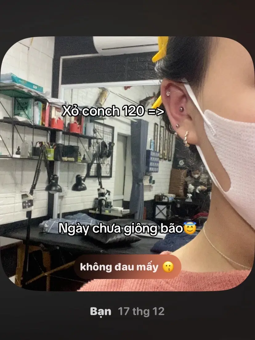 #xokhuyen #apxe #conch 