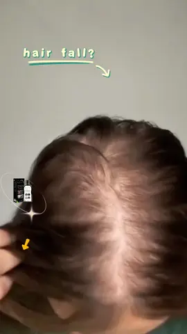 If you have thin hair,try this shampoo #hairshampoo #antihairloss #hairlosssolutions 